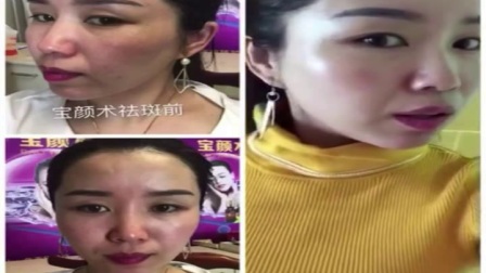 最新宝颜术，重塑美丽的秘密武器