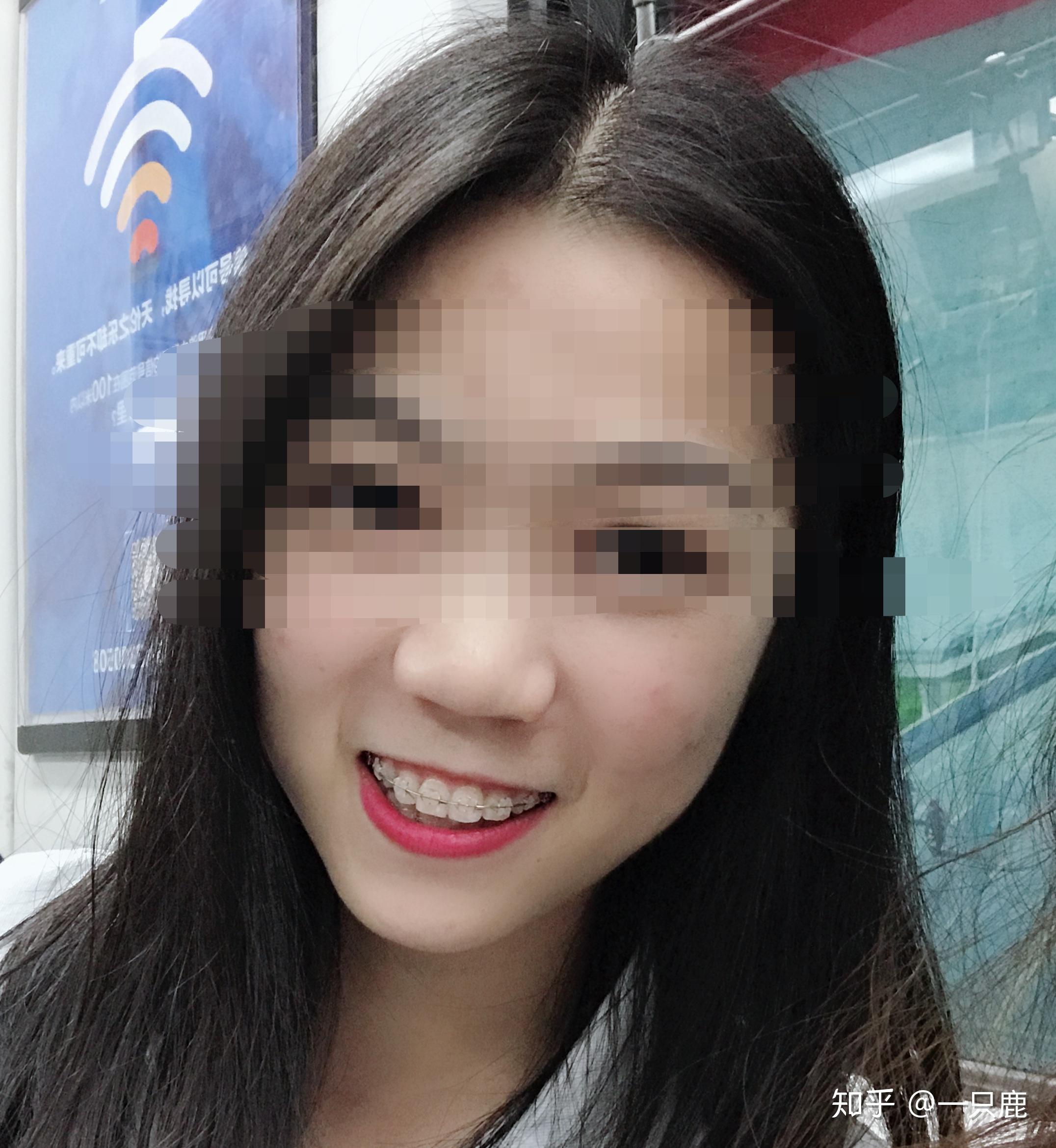 小虎牙最新魅力，时尚潮流与个性风采的完美结合展现独特风采